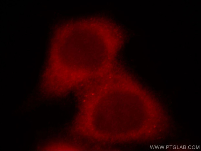 STIP1 Antibody in Immunocytochemistry (ICC/IF)