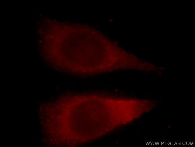 YWHAH Antibody in Immunocytochemistry (ICC/IF)