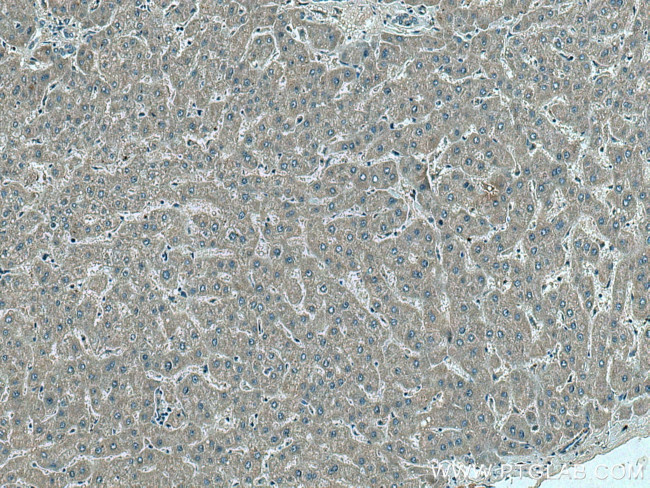 MRPS12 Antibody in Immunohistochemistry (Paraffin) (IHC (P))