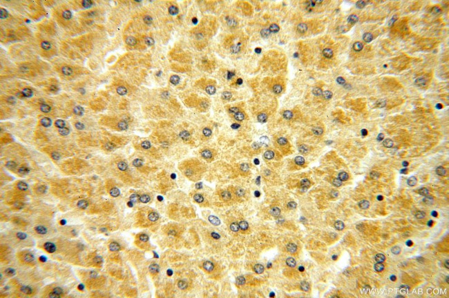 RPL21 Antibody in Immunohistochemistry (Paraffin) (IHC (P))