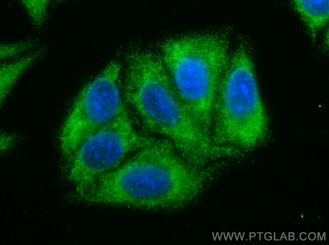 LOXL2 Antibody in Immunocytochemistry (ICC/IF)