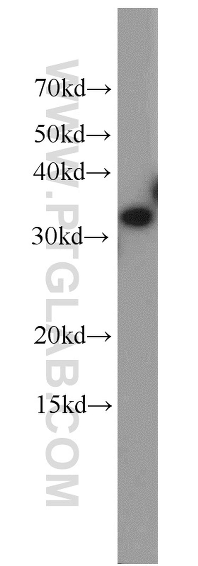 ESD Antibody in Western Blot (WB)