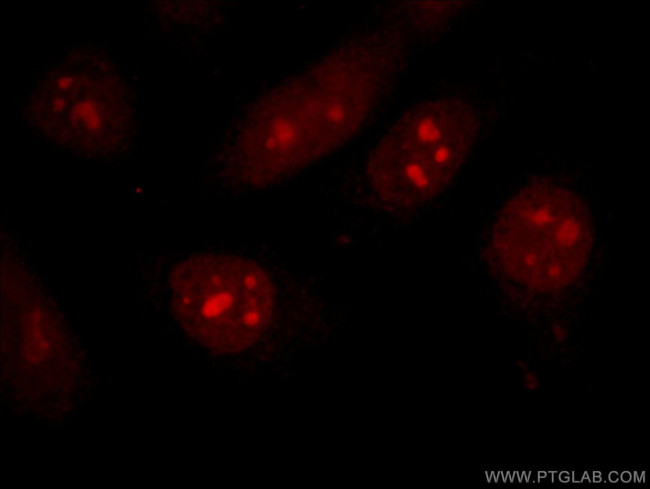 CDCA7 Antibody in Immunocytochemistry (ICC/IF)