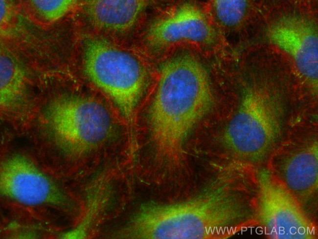 TRIM62 Antibody in Immunocytochemistry (ICC/IF)