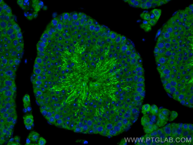 GSG1 Antibody in Immunohistochemistry (PFA fixed) (IHC (PFA))