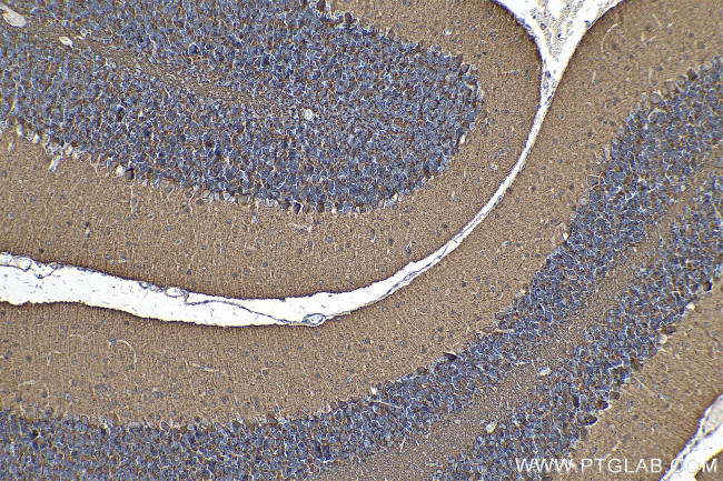 PCDHA5 Antibody in Immunohistochemistry (Paraffin) (IHC (P))
