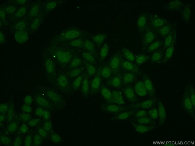 POP4 Antibody in Immunocytochemistry (ICC/IF)