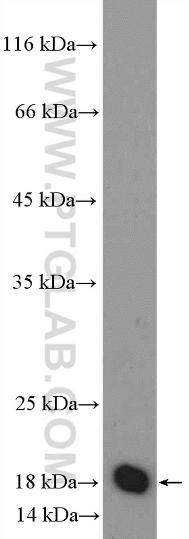 MRPS25 Antibody in Western Blot (WB)