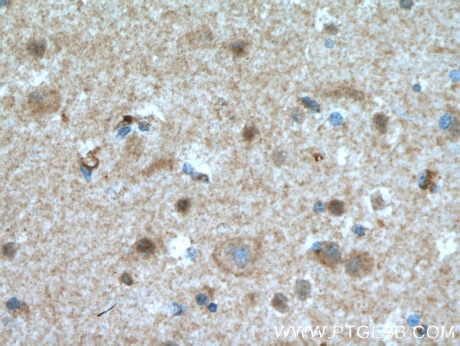HJURP Antibody in Immunohistochemistry (Paraffin) (IHC (P))