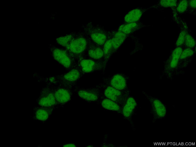 HSPB8 Antibody in Immunocytochemistry (ICC/IF)