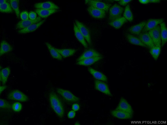 ARFGAP3 Antibody in Immunocytochemistry (ICC/IF)