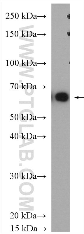 MAGEA10 Antibody in Western Blot (WB)