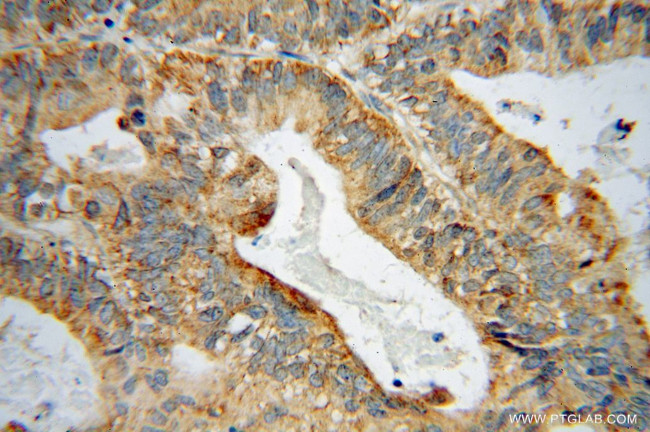 GRB14 Antibody in Immunohistochemistry (Paraffin) (IHC (P))
