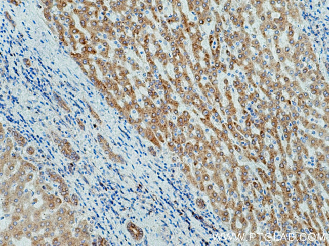 WWOX Antibody in Immunohistochemistry (Paraffin) (IHC (P))