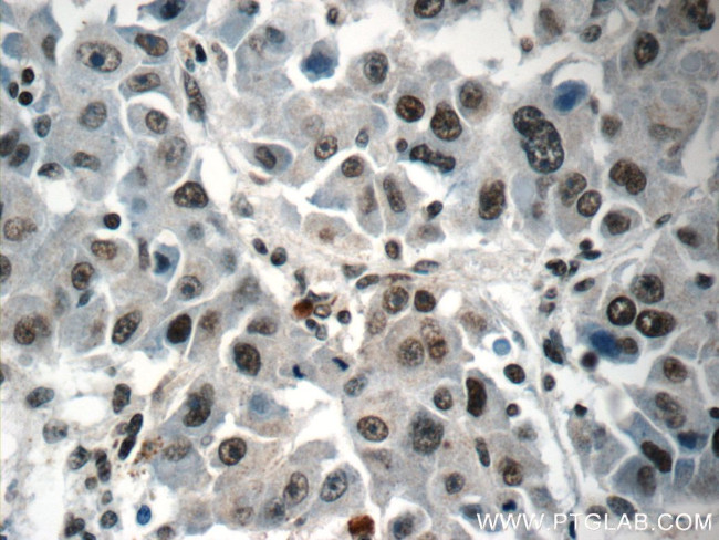 HIST2H2AA4 Antibody in Immunohistochemistry (Paraffin) (IHC (P))