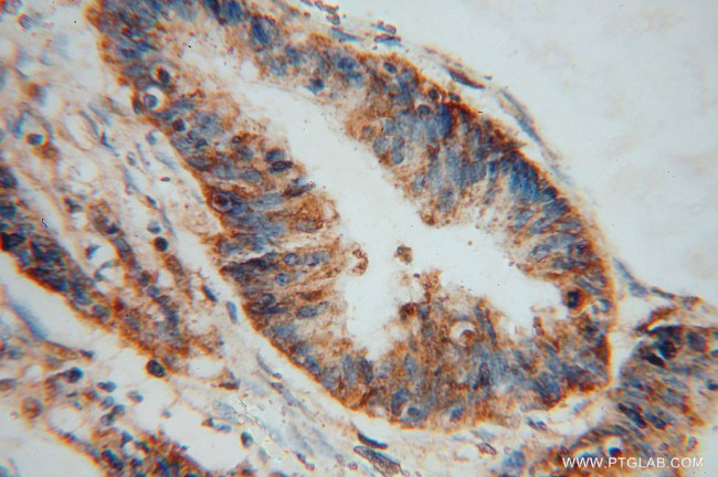 PDXK Antibody in Immunohistochemistry (Paraffin) (IHC (P))