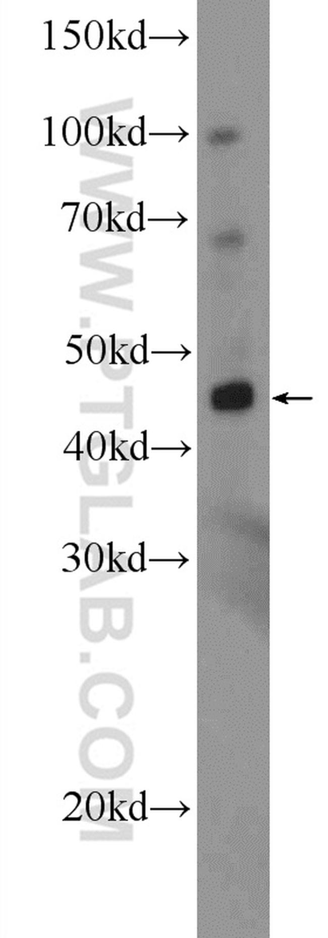 MPPE1 Antibody in Western Blot (WB)