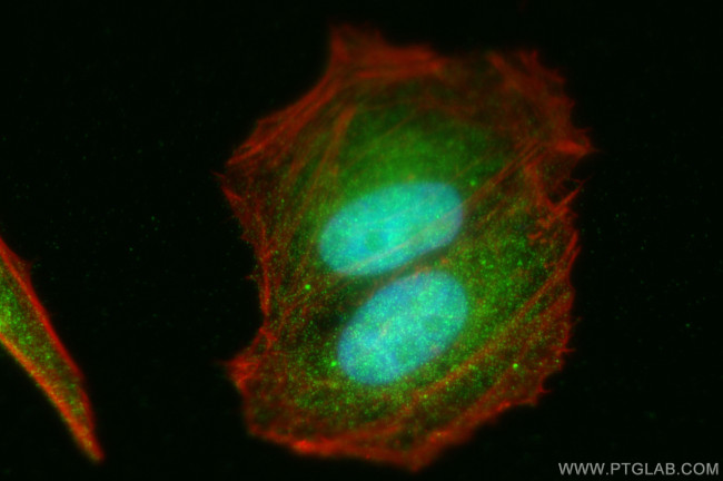 RRAGD Antibody in Immunocytochemistry (ICC/IF)