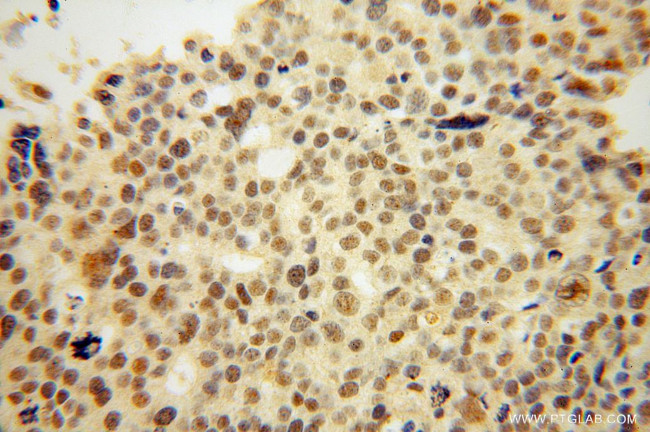 THOC6 Antibody in Immunohistochemistry (Paraffin) (IHC (P))