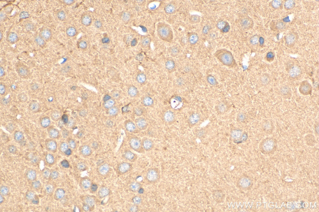 MOAP1 Antibody in Immunohistochemistry (Paraffin) (IHC (P))