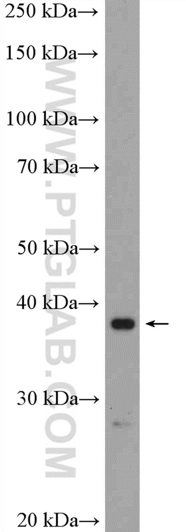 RRS1 Antibody in Western Blot (WB)