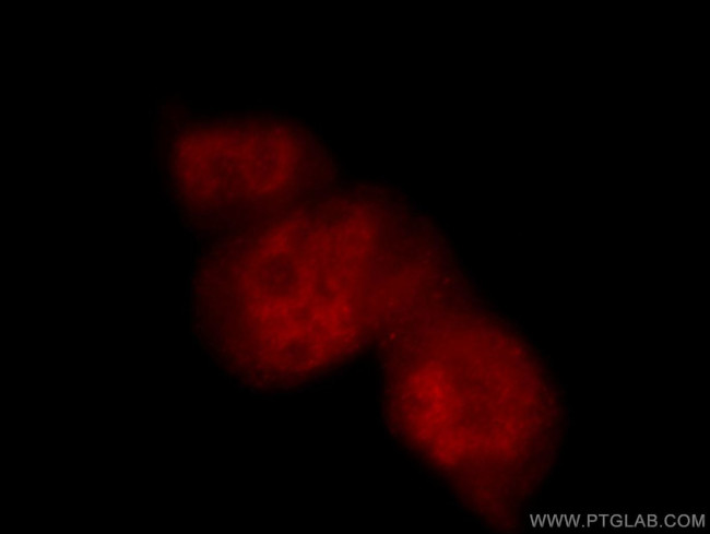 POLR2F Antibody in Immunocytochemistry (ICC/IF)