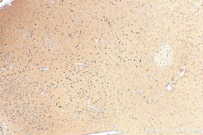 CLPTM1 Antibody in Immunohistochemistry (Paraffin) (IHC (P))
