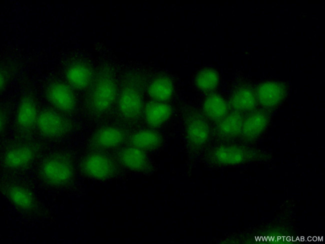 POLR3D Antibody in Immunocytochemistry (ICC/IF)