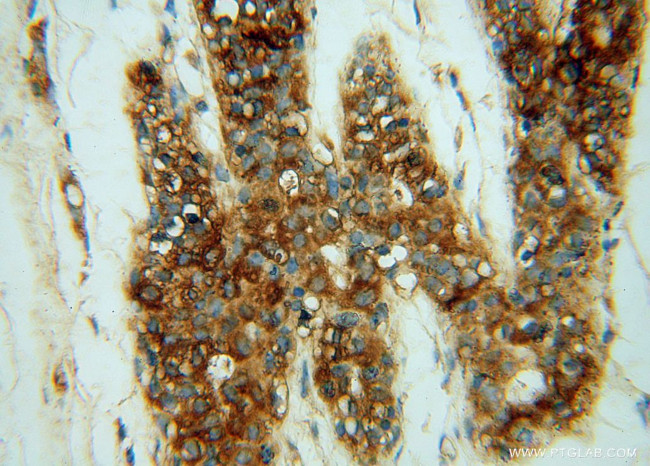 CHST12 Antibody in Immunohistochemistry (Paraffin) (IHC (P))