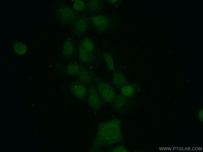 MAD2L1BP Antibody in Immunocytochemistry (ICC/IF)