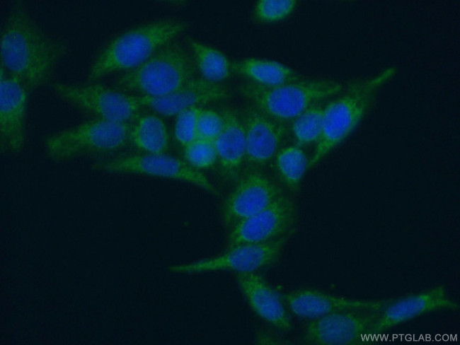 CRIP1 Antibody in Immunocytochemistry (ICC/IF)