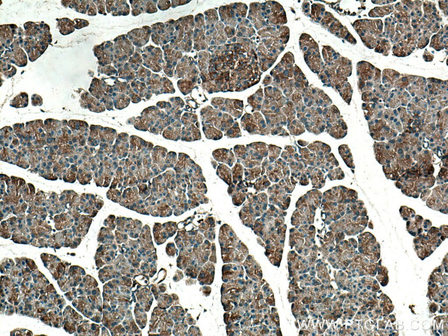 TRIAP1 Antibody in Immunohistochemistry (Paraffin) (IHC (P))
