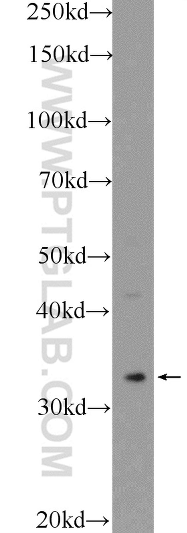 Cyclophilin E Antibody in Western Blot (WB)