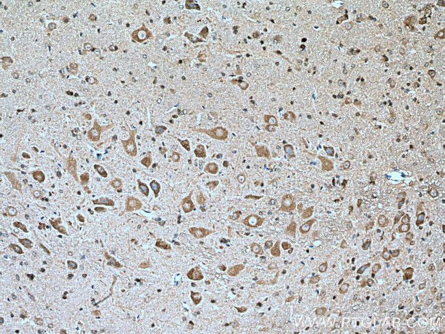 GLRB Antibody in Immunohistochemistry (Paraffin) (IHC (P))