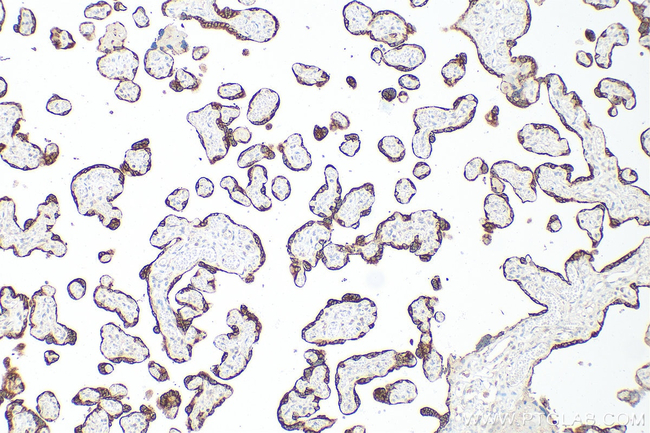 PSG3 Antibody in Immunohistochemistry (Paraffin) (IHC (P))