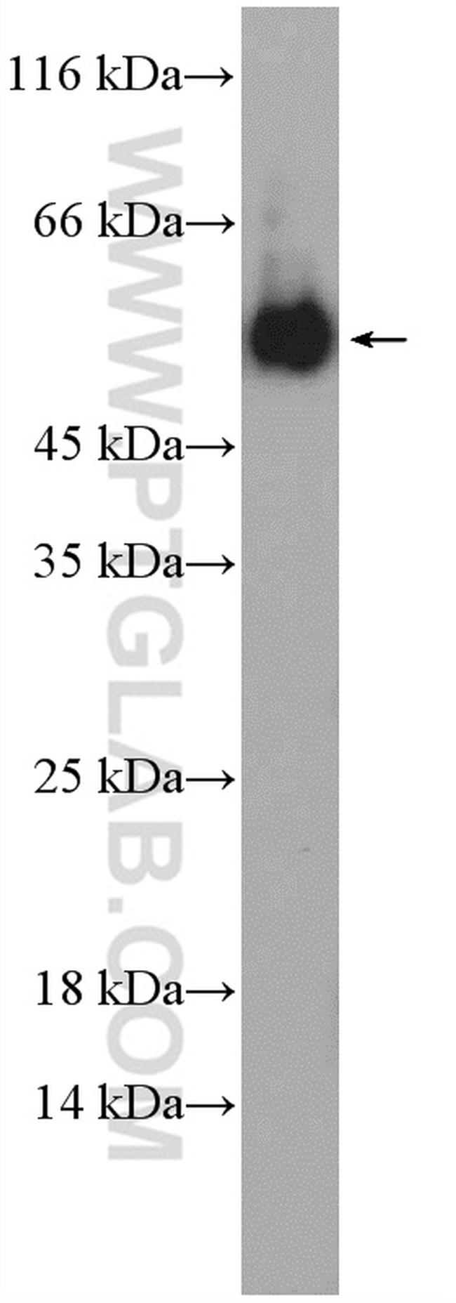 NDP Antibody in Western Blot (WB)