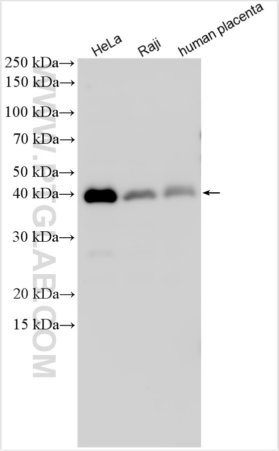 NR2F6 Antibody in Western Blot (WB)