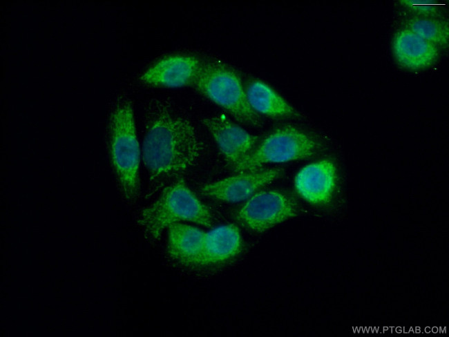 USP30 Antibody in Immunocytochemistry (ICC/IF)
