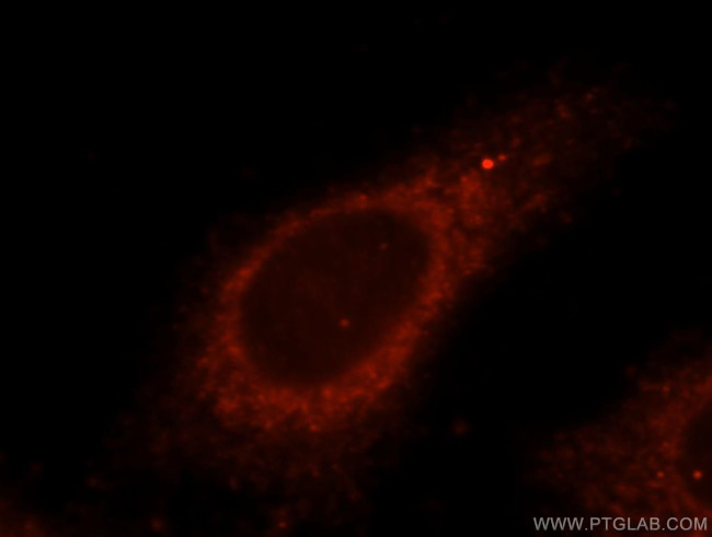 USP2 Antibody in Immunocytochemistry (ICC/IF)
