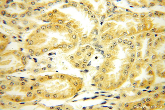PLEKHA8 Antibody in Immunohistochemistry (Paraffin) (IHC (P))