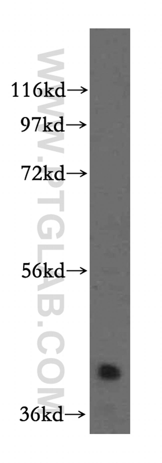 RBM4B Antibody in Western Blot (WB)