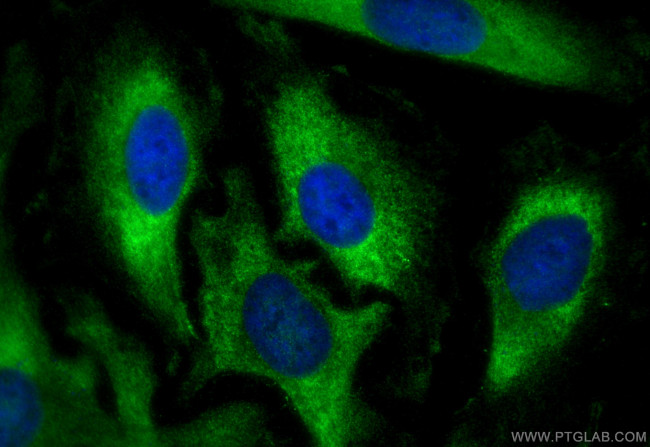 BTF3 Antibody in Immunocytochemistry (ICC/IF)