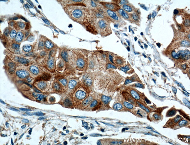 ANXA9 Antibody in Immunohistochemistry (Paraffin) (IHC (P))