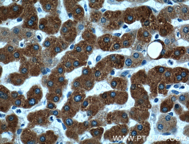 ECE2 Antibody in Immunohistochemistry (Paraffin) (IHC (P))
