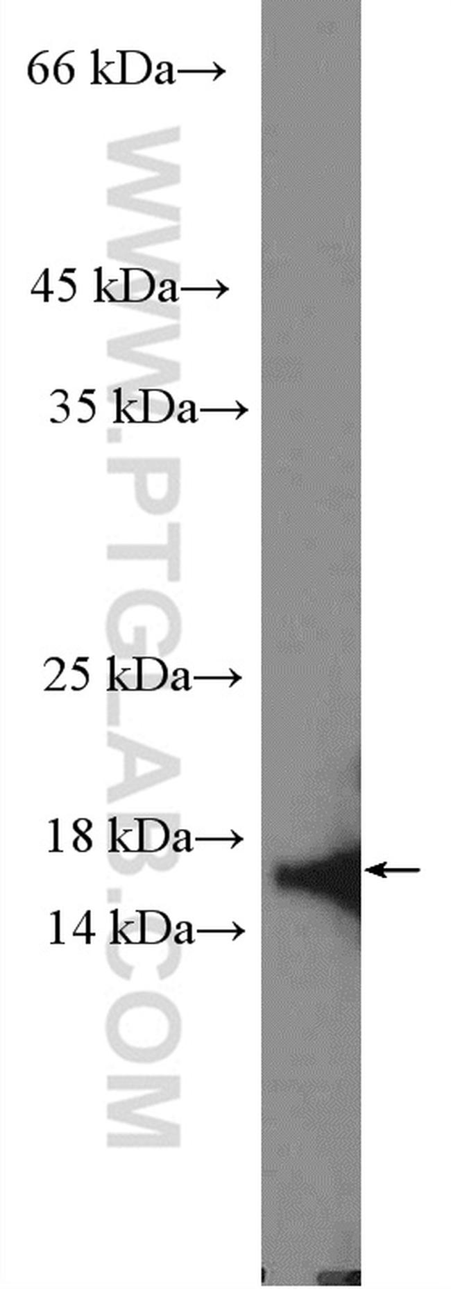 CDK2AP2 Antibody in Western Blot (WB)