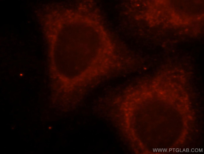 UGT2B4 Antibody in Immunocytochemistry (ICC/IF)