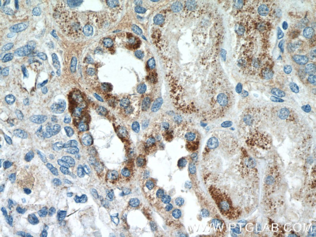 SSU72 Antibody in Immunohistochemistry (Paraffin) (IHC (P))