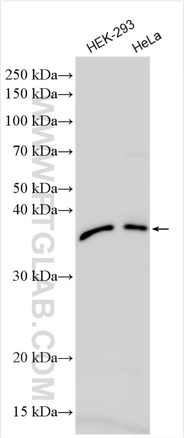 HEMK1 Antibody in Western Blot (WB)