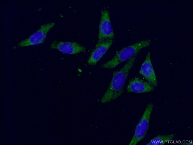 AKR1B1 Antibody in Immunocytochemistry (ICC/IF)