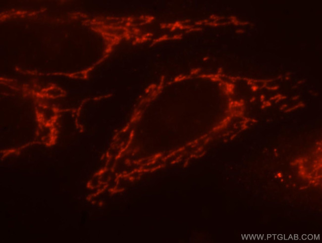 CaMKII delta Antibody in Immunocytochemistry (ICC/IF)